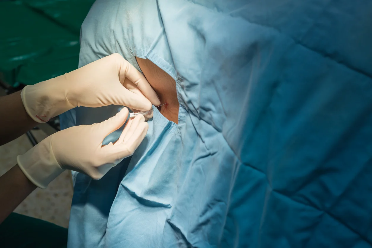 Automobile Accidents